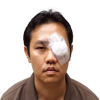 Downingtown Workers’ Compensation lawyers recover compensation for welders with eye injuries.
