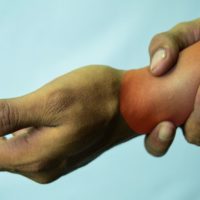Are Repetitive Stress Injuries Covered by Workers’ Compensation?