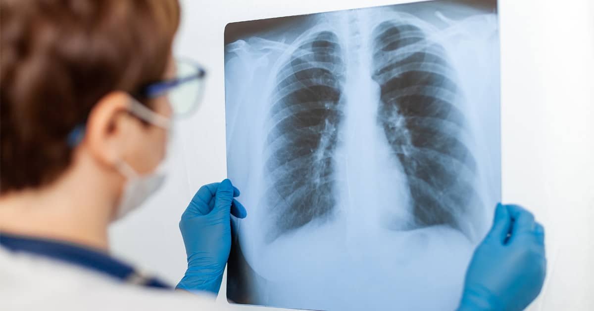 Our Chester County Workers’ Compensation Lawyers at Wusinich, Sweeney & Ryan, LLC Help Workers Suffering From Occupational Lung Diseases