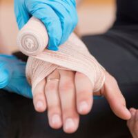 What Are Common Types of Burn Injuries That Occur in the Workplace?